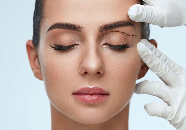 eyelid surgery